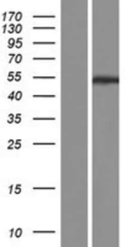Novus Biologicals™ PPP2R2C Overexpression Lysate