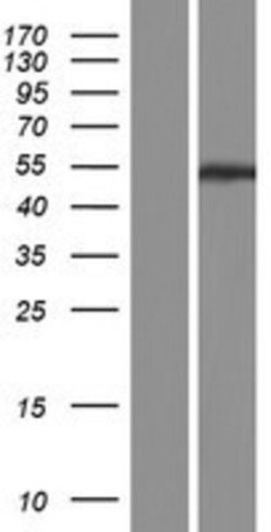 Novus Biologicals&trade;&nbsp;PPP2R2C Overexpression Lysate