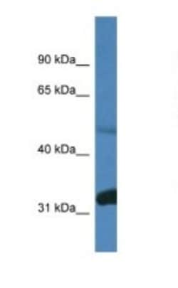 PPP2R2D Antibody, Novus Biologicals 100&mu;L; Unlabeled:Antibodies, Polyclonal