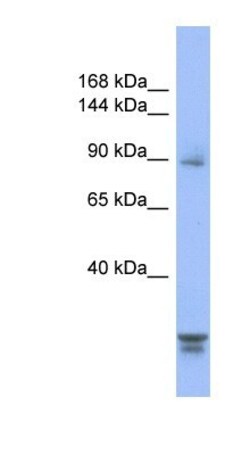 PPP2R3A Antibody, Novus Biologicals 100&mu;L; Unlabeled:Antibodies, Polyclonal