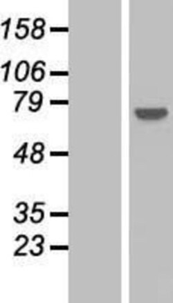 Novus Biologicals&trade;&nbsp;PPP2R3A Overexpression Lysate