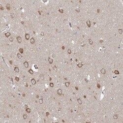 PPP2R3A Antibody, Novus Biologicals:Antibodies:Primary Antibodies
