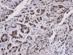 PP2A alpha Antibody, Novus Biologicals 0.1mL; Unlabeled:Antibodies, Polyclonal