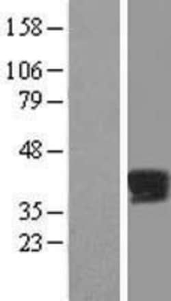 Novus Biologicals&trade;&nbsp;PPP2R4 Overexpression Lysate