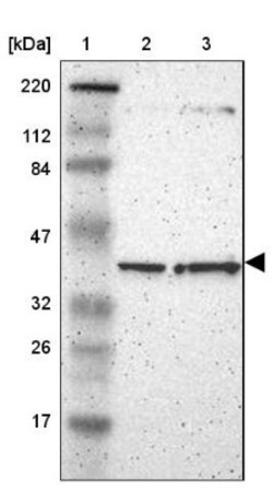 PPP2R4 Antibody, Novus Biologicals 0.1mL; Unlabeled:Antibodies, Polyclonal