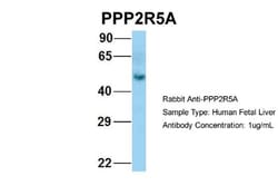 PPP2R5A Antibody, Novus Biologicals 100 &mu;L | Buy Online | Novus Biologicals | Fisher Scientific