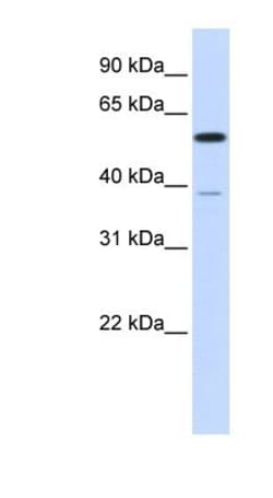PPP2R5A Antibody, Novus Biologicals 100 &mu;L | Buy Online | Novus Biologicals | Fisher Scientific