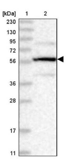 PPP2R5B Antibody, Novus Biologicals 0.1mL; Unlabeled:Antibodies, Polyclonal