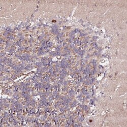 PPP2R5B Antibody, Novus Biologicals 0.1mL; Unlabeled:Antibodies, Polyclonal