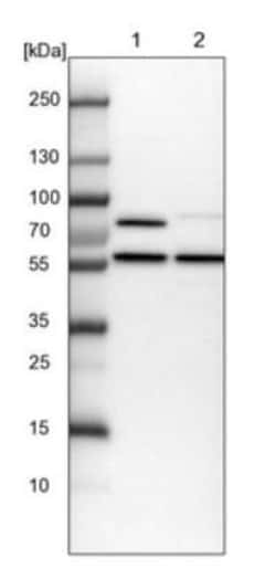 PPP2R5B Antibody, Novus Biologicals 0.1mL; Unlabeled:Antibodies, Polyclonal