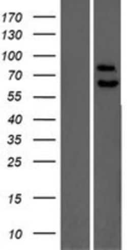 Novus Biologicals&trade;&nbsp;PPP2R5C Overexpression Lysate