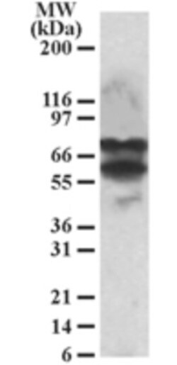 PPP2R5D Antibody, Novus Biologicals 0.1mg; Unlabeled:Antibodies, Polyclonal