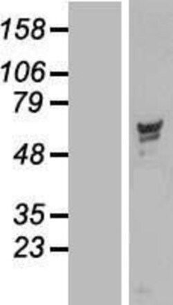Novus Biologicals&trade;&nbsp;PPP2R5D Overexpression Lysate
