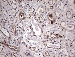 PPP2R5D Antibody (OTI5E7), Novus Biologicals 0.1 mL | Buy Online | Novus Biologicals | Fisher Scientific