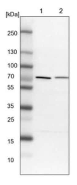 PPP2R5D Antibody, Novus Biologicals 25 &mu;L; Unlabeled:Antibodies, Polyclonal