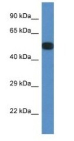 PPP2R5E Antibody, Novus Biologicals:Antibodies:Primary Antibodies