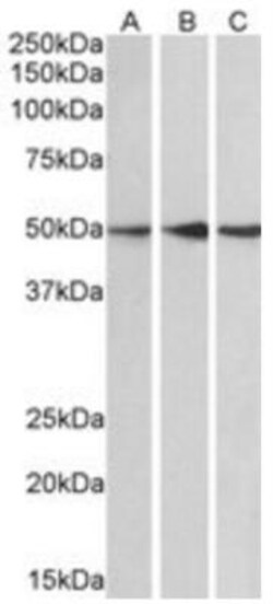 PPP2R5E Antibody, Novus Biologicals 0.1mg; Unlabeled:Antibodies, Polyclonal