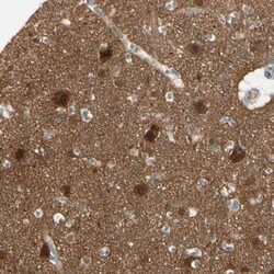 PPP3CB Antibody, Novus Biologicals 0.1mL; Unlabeled:Antibodies, Polyclonal