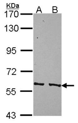 PPP3CC Antibody, Novus Biologicals 0.1mL; Unlabeled:Antibodies, Polyclonal