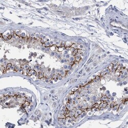 PPP3CC Antibody, Novus Biologicals:Antibodies:Primary Antibodies