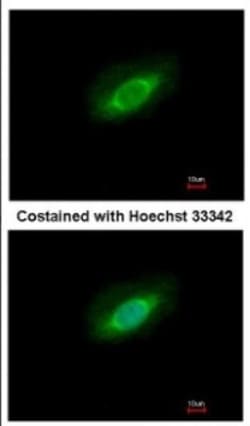 PP4/PPP4C Antibody, Novus Biologicals 0.1mL; Unlabeled:Antibodies, Polyclonal