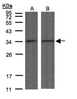 PP4/PPP4C Antibody, Novus Biologicals 0.1 mL | Buy Online | Novus Biologicals | Fisher Scientific
