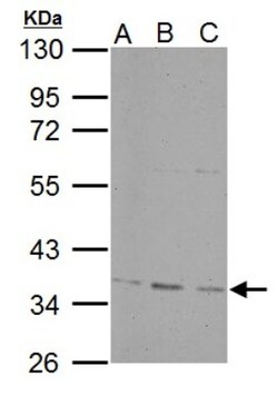 PP4/PPP4C Antibody, Novus Biologicals 0.1mL; Unlabeled:Antibodies, Polyclonal