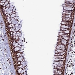 PP4/PPP4C Antibody, Novus Biologicals 0.1mL; Unlabeled:Antibodies, Polyclonal