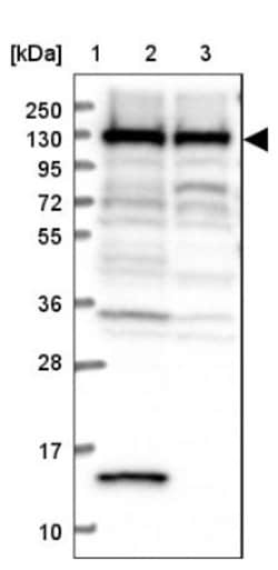 PPP4R1 Antibody, Novus Biologicals 25 &mu;L | Buy Online | Novus Biologicals | Fisher Scientific
