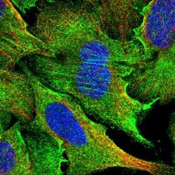 PPP4R1 Antibody, Novus Biologicals 25 &mu;L | Buy Online | Novus Biologicals | Fisher Scientific