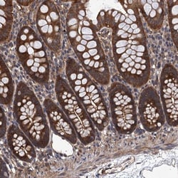 PPP4R1 Antibody, Novus Biologicals 25 &mu;L | Buy Online | Novus Biologicals | Fisher Scientific