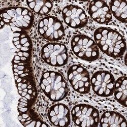 PPP4R1 Antibody, Novus Biologicals 0.1mL; Unlabeled:Antibodies, Polyclonal