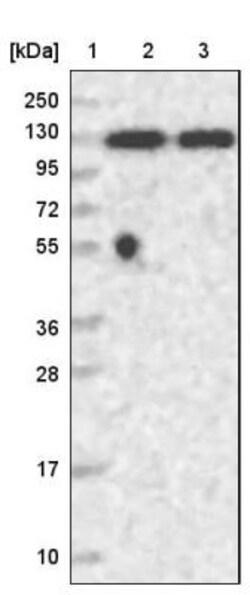 PPP4R1 Antibody, Novus Biologicals 0.1mL; Unlabeled:Antibodies, Polyclonal
