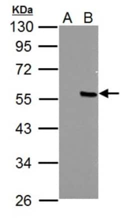 PPP4R2 Antibody, Novus Biologicals 0.1mL; Unlabeled:Antibodies, Polyclonal