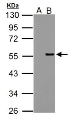 PPP4R2 Antibody, Novus Biologicals 0.1mL; Unlabeled:Antibodies, Polyclonal