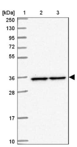 PPP6C Antibody, Novus Biologicals 0.1mL; Unlabeled:Antibodies, Polyclonal