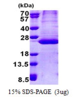 Novus Biologicals&trade;&nbsp;Recombinant Human PPPDE2 His Protein