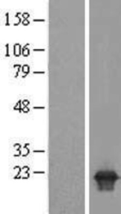 Novus Biologicals&trade;&nbsp;PPPDE2 Overexpression Lysate
