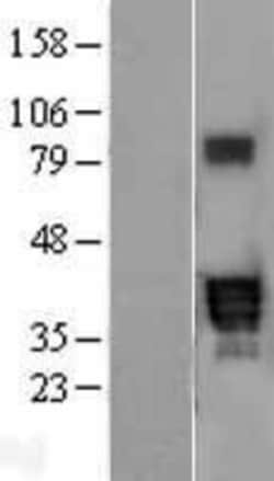 Novus Biologicals&trade;&nbsp;PPT2 Overexpression Lysate