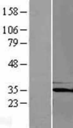 Novus Biologicals™ PQBP1 Overexpression Lysate