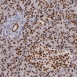 PQBP1 Antibody, Novus Biologicals 25 &mu;L; Unlabeled:Antibodies, Polyclonal