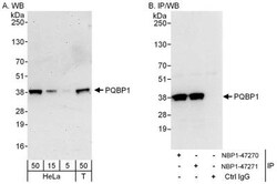 PQBP1 Antibody, Novus Biologicals 0.1mL; Unlabeled:Antibodies, Polyclonal