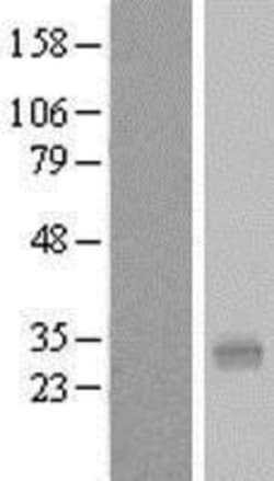 Novus Biologicals&trade;&nbsp;PQLC1 Overexpression Lysate
