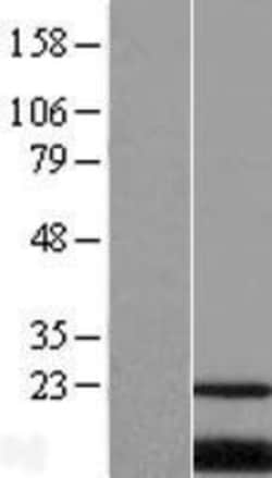 Novus Biologicals&trade;&nbsp;PQLC2 Overexpression Lysate