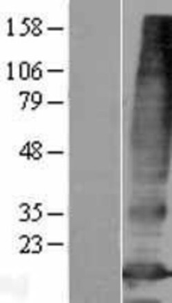 Novus Biologicals&trade;&nbsp;PQLC3 Overexpression Lysate
