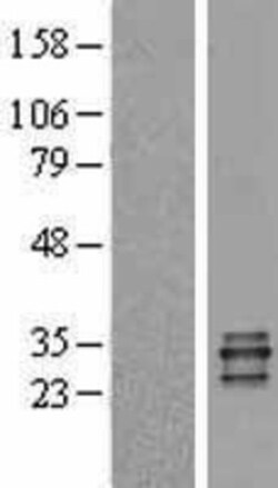 Novus Biologicals™ Proteinase 3/Myeloblastin/PRTN3 Overexpression Lysate