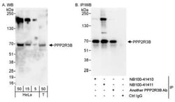 PR48 Antibody, Novus Biologicals 0.1mg; Unlabeled:Antibodies, Polyclonal