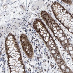 PRAF1 Antibody, Novus Biologicals 0.1mL; Unlabeled:Antibodies, Polyclonal