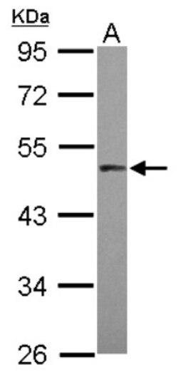 PRAK Antibody, Novus Biologicals 0.1mL; Unlabeled:Antibodies, Polyclonal