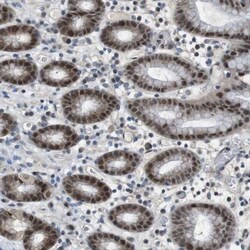 PRAK Antibody, Novus Biologicals:Antibodies:Primary Antibodies